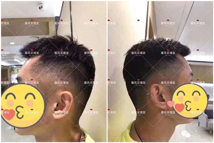 尊龙人生就是博d88 假发打结严重怎么办